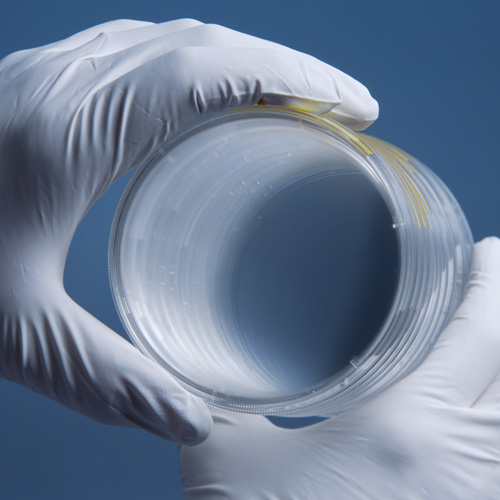 TPP Tissue Culture Dish with surface treated growth area for tissue